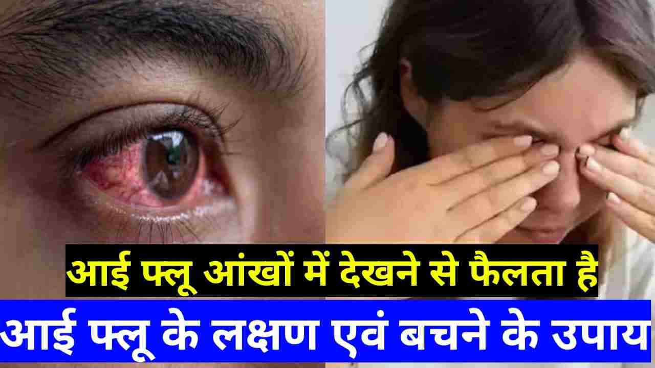 Eye Flu hone ke Karan evam Mukhya Lakshan